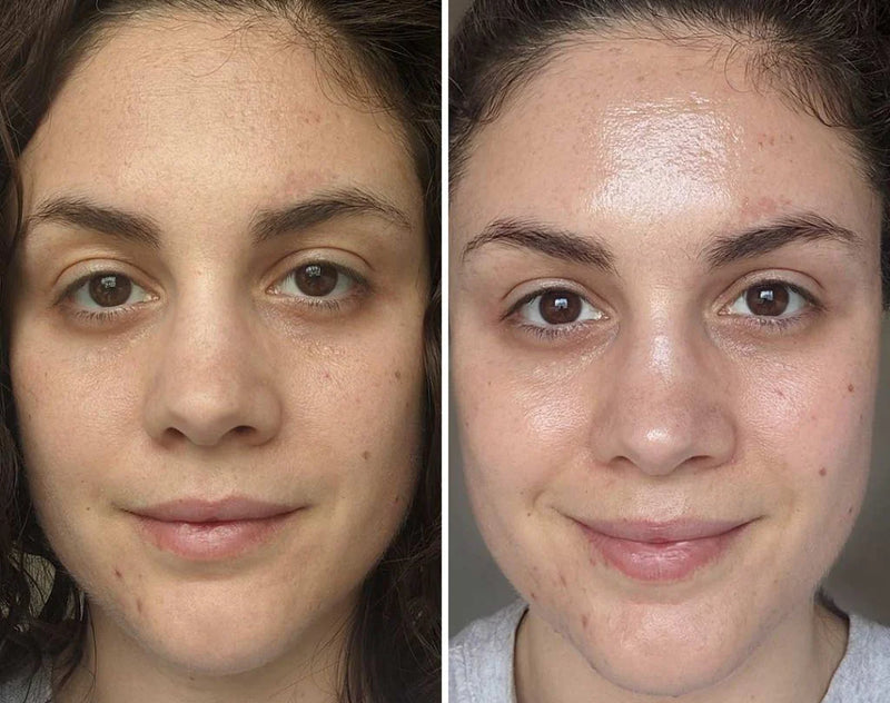 "I didn't even rinse it off. My skin drank it in. Dewy, plump, juicy, like magic."